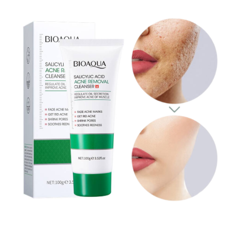 Jabon Acido Salicilico Bioaqua 100g
